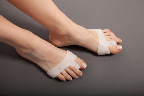 Вальгусная деформация Hallux Valgus