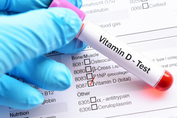 Сдача анализа на витамин Д
